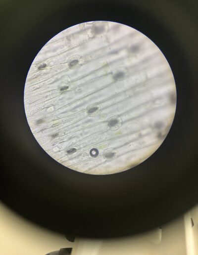 observation stomates BTS MVAOE